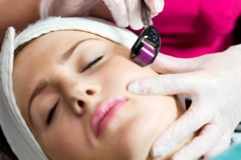 micro-needling-derma-roller-london